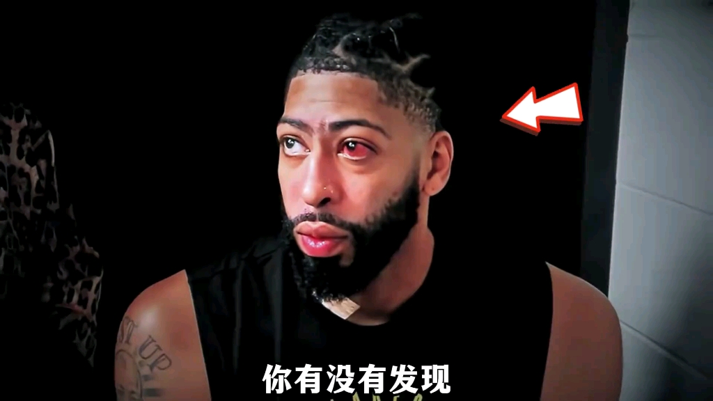 NBA-浓眉赛季中视网膜脱落目前已接受修复手术