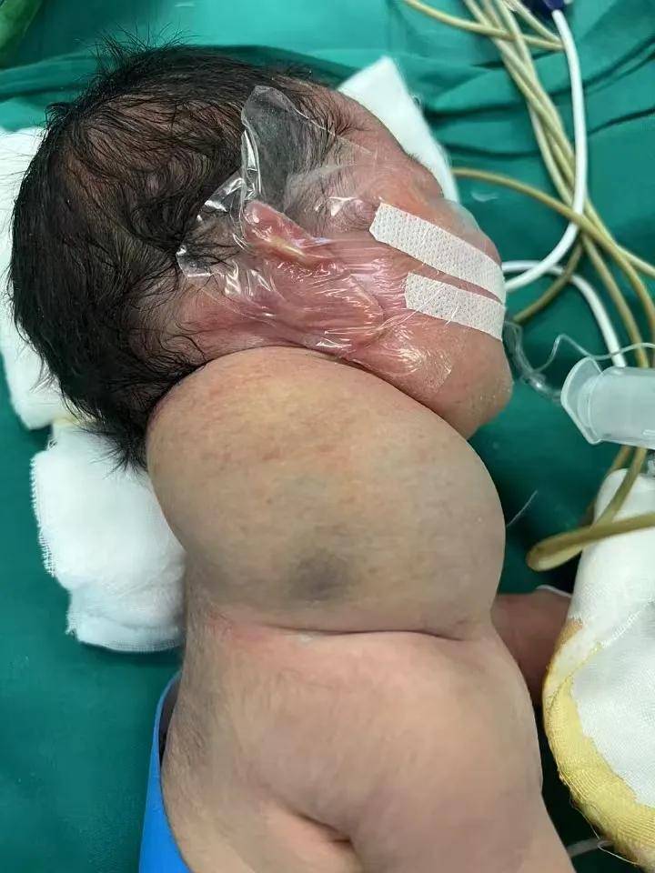 灰熊JJJ正式接受脚趾手术三个月后重新评估的简单介绍